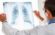 Anvisa libera novo tratamento para pacientes com câncer de pulmão